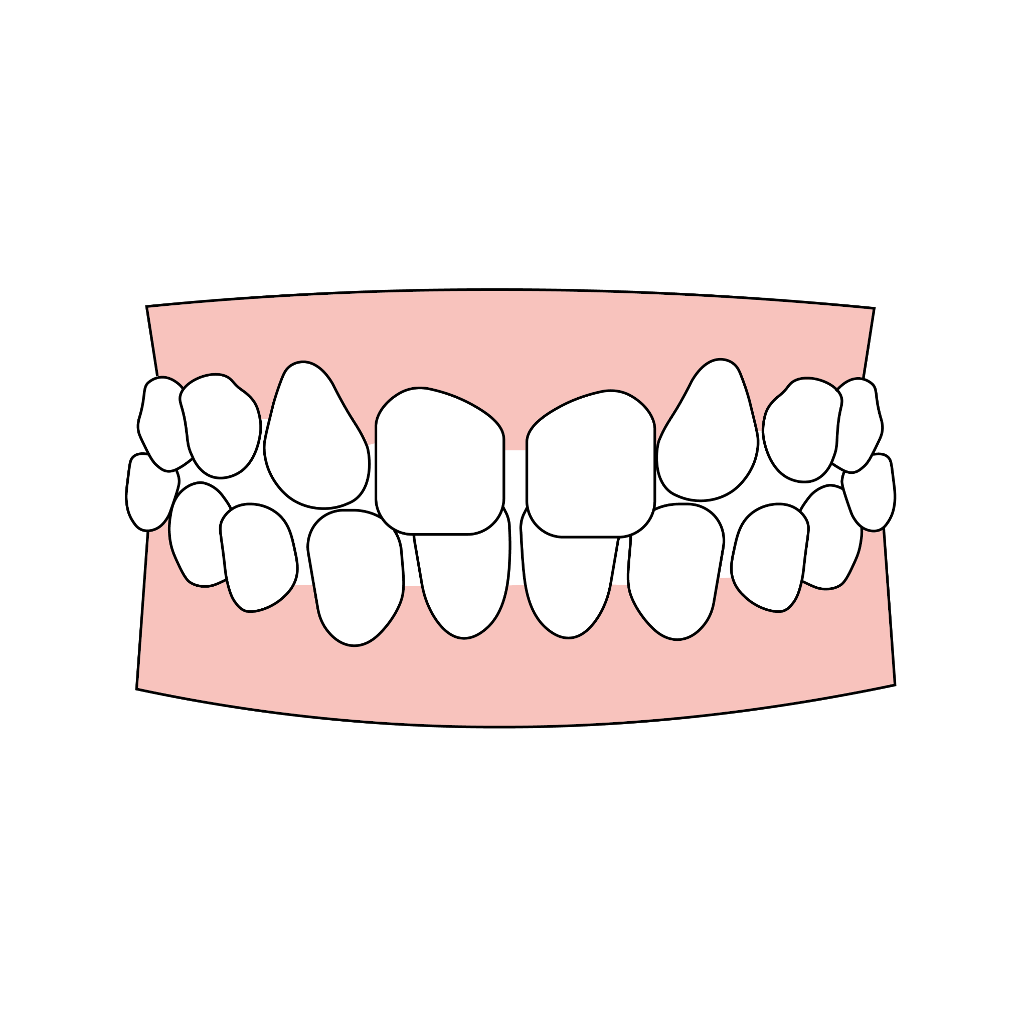 LightForce LightForce